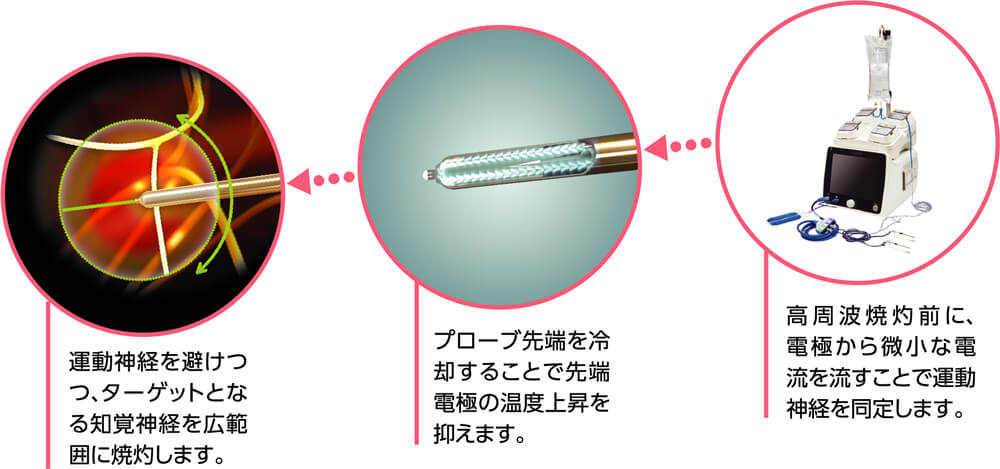 クーリーフ作用機序